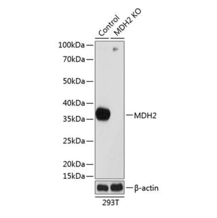 Western Blot - Anti-MDH2 Antibody (A305336) - Antibodies.com