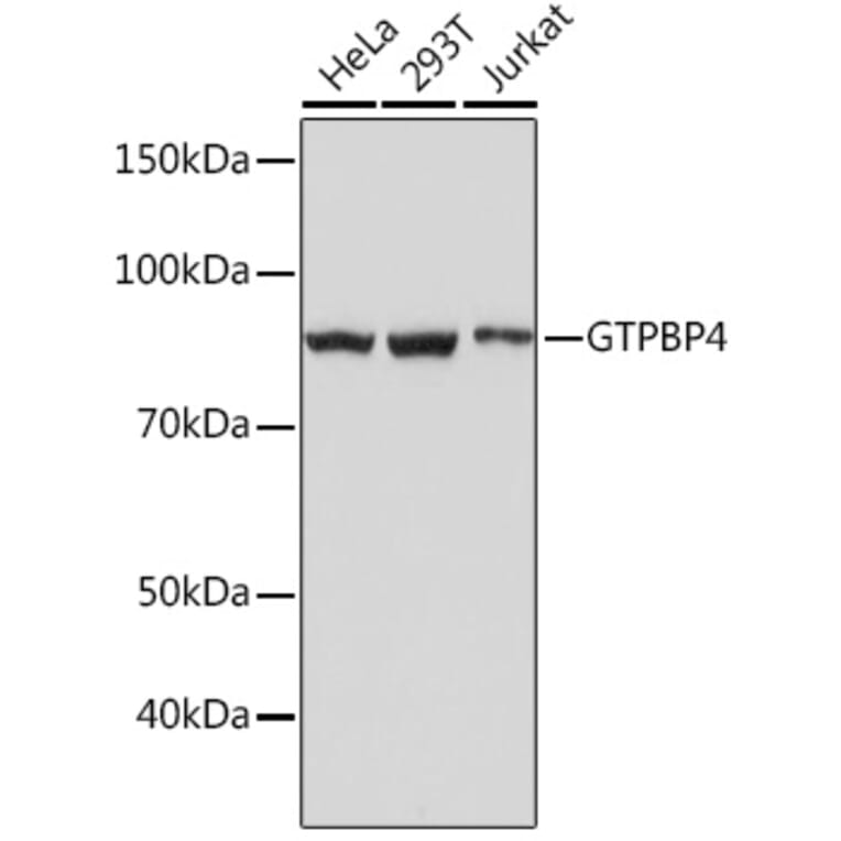 Western Blot - Anti-GTPBP4/NOG1 Antibody [ARC1115] (A305337) - Antibodies.com