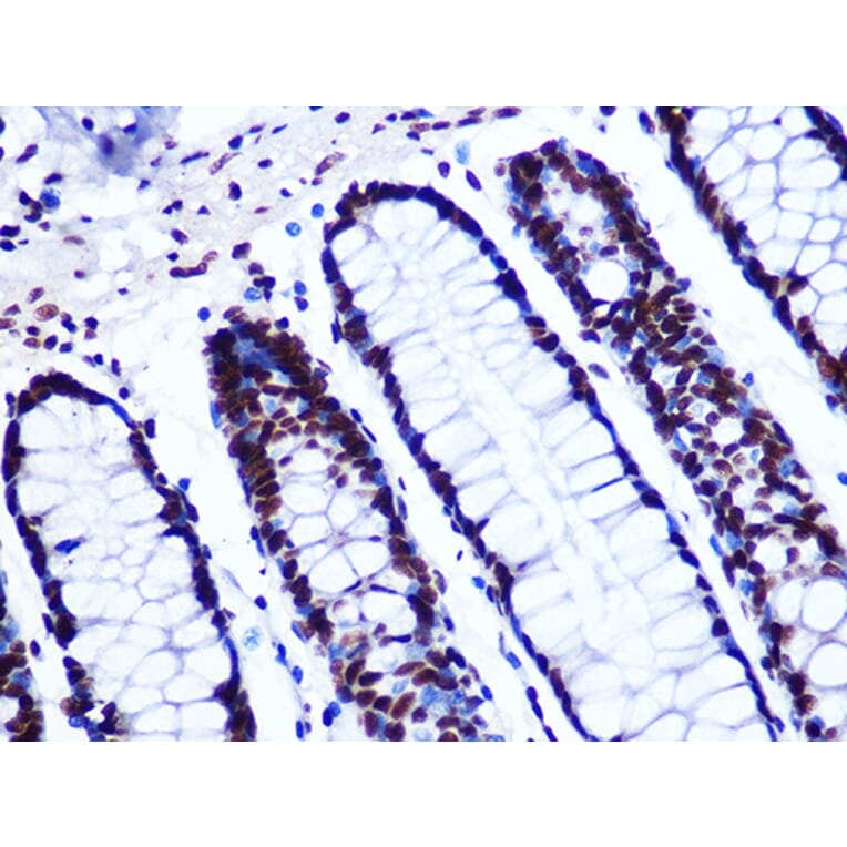 Immunohistochemistry - Anti-GTPBP4/NOG1 Antibody [ARC1115] (A305337) - Antibodies.com