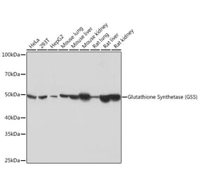Western Blot - Anti-Glutathione Synthetase Antibody [ARC0630] (A305338) - Antibodies.com
