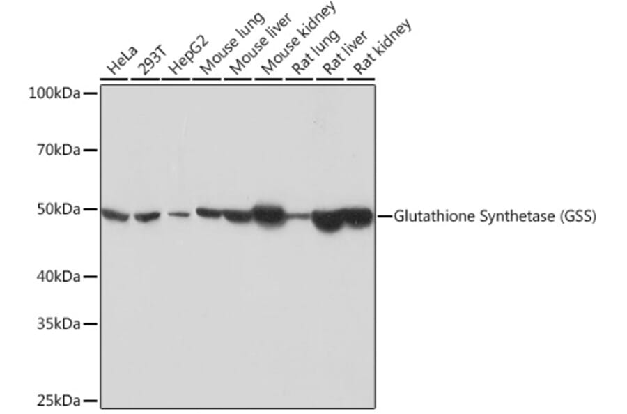 Western Blot - Anti-Glutathione Synthetase Antibody [ARC0630] (A305338) - Antibodies.com
