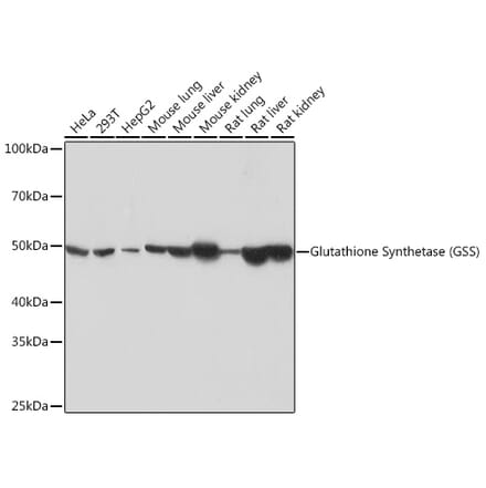 Western Blot - Anti-Glutathione Synthetase Antibody [ARC0630] (A305338) - Antibodies.com