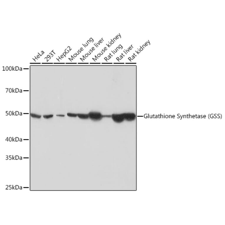 Western Blot - Anti-Glutathione Synthetase Antibody [ARC0630] (A305338) - Antibodies.com