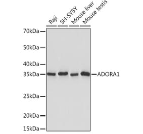 Western Blot - Anti-Adenosine A1 Receptor Antibody [ARC1987] (A305340) - Antibodies.com