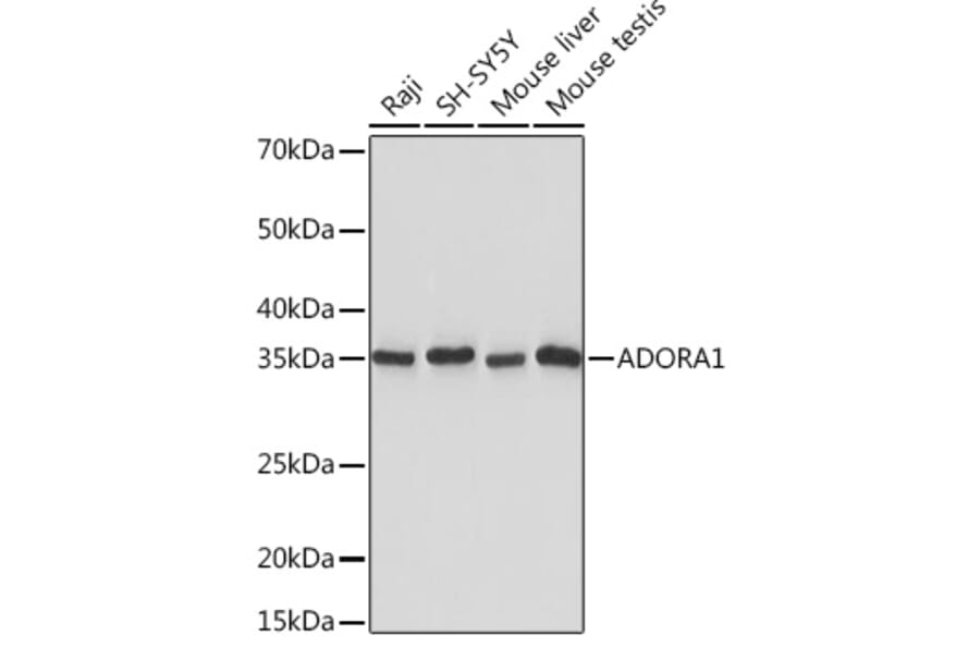 Western Blot - Anti-Adenosine A1 Receptor Antibody [ARC1987] (A305340) - Antibodies.com