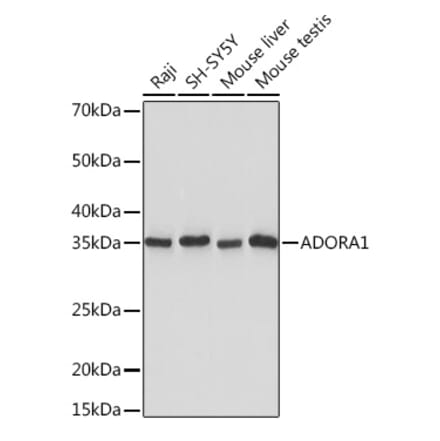 Western Blot - Anti-Adenosine A1 Receptor Antibody [ARC1987] (A305340) - Antibodies.com