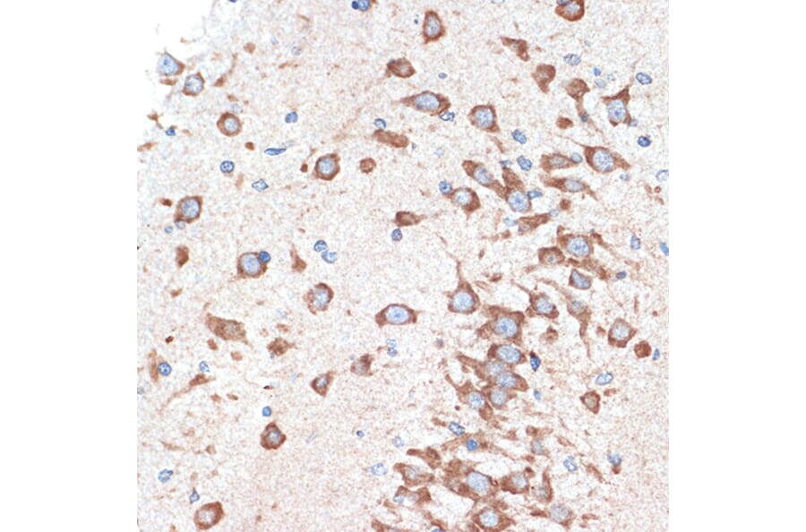 Immunohistochemistry - Anti-Adenosine A1 Receptor Antibody [ARC1987] (A305340) - Antibodies.com