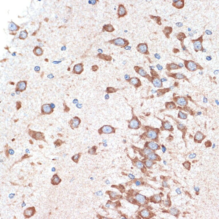 Immunohistochemistry - Anti-Adenosine A1 Receptor Antibody [ARC1987] (A305340) - Antibodies.com