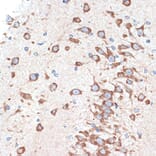 Immunohistochemistry - Anti-Adenosine A1 Receptor Antibody [ARC1987] (A305340) - Antibodies.com