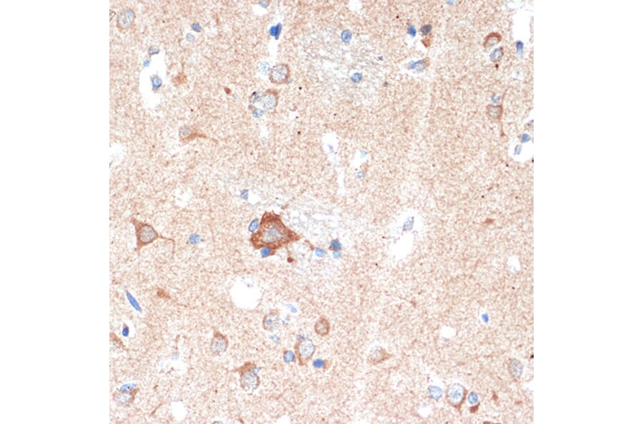 Immunohistochemistry - Anti-Adenosine A1 Receptor Antibody [ARC1987] (A305340) - Antibodies.com