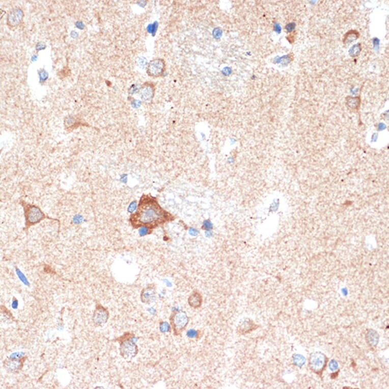 Immunohistochemistry - Anti-Adenosine A1 Receptor Antibody [ARC1987] (A305340) - Antibodies.com