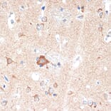 Immunohistochemistry - Anti-Adenosine A1 Receptor Antibody [ARC1987] (A305340) - Antibodies.com