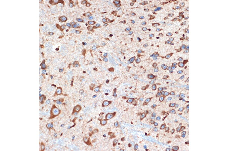 Immunohistochemistry - Anti-Adenosine A1 Receptor Antibody [ARC1987] (A305340) - Antibodies.com