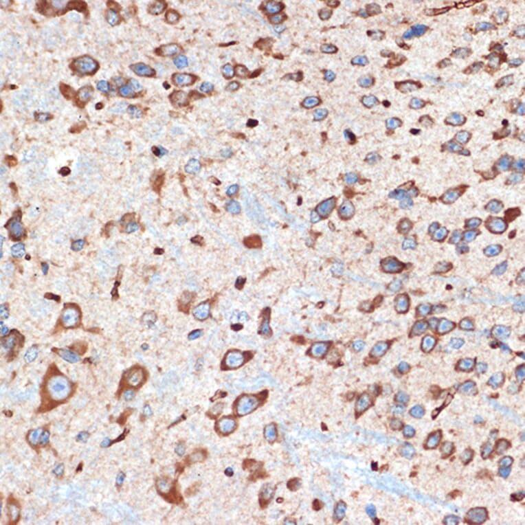 Immunohistochemistry - Anti-Adenosine A1 Receptor Antibody [ARC1987] (A305340) - Antibodies.com