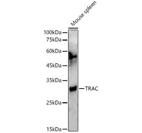 Western Blot - Anti-TCR alpha Antibody (A305341) - Antibodies.com