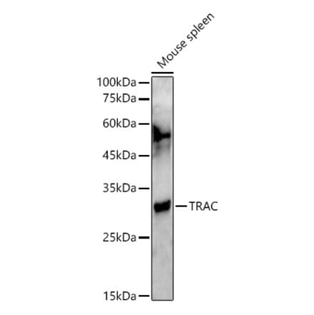 Western Blot - Anti-TCR alpha Antibody (A305341) - Antibodies.com