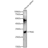 Western Blot - Anti-TCR alpha Antibody (A305341) - Antibodies.com