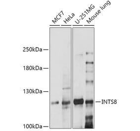 Western Blot - Anti-FLJ20530 Antibody (A305342) - Antibodies.com