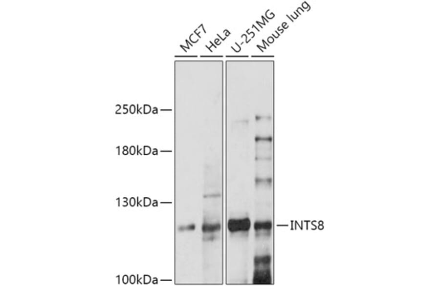 Western Blot - Anti-FLJ20530 Antibody (A305342) - Antibodies.com