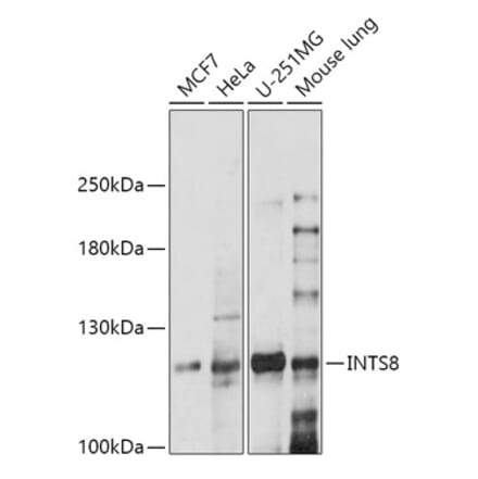 Western Blot - Anti-FLJ20530 Antibody (A305342) - Antibodies.com