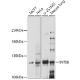 Western Blot - Anti-FLJ20530 Antibody (A305342) - Antibodies.com