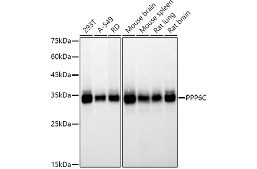 Western Blot - Anti-PPP6C/Ppv Antibody [ARC2709] (A305343) - Antibodies.com