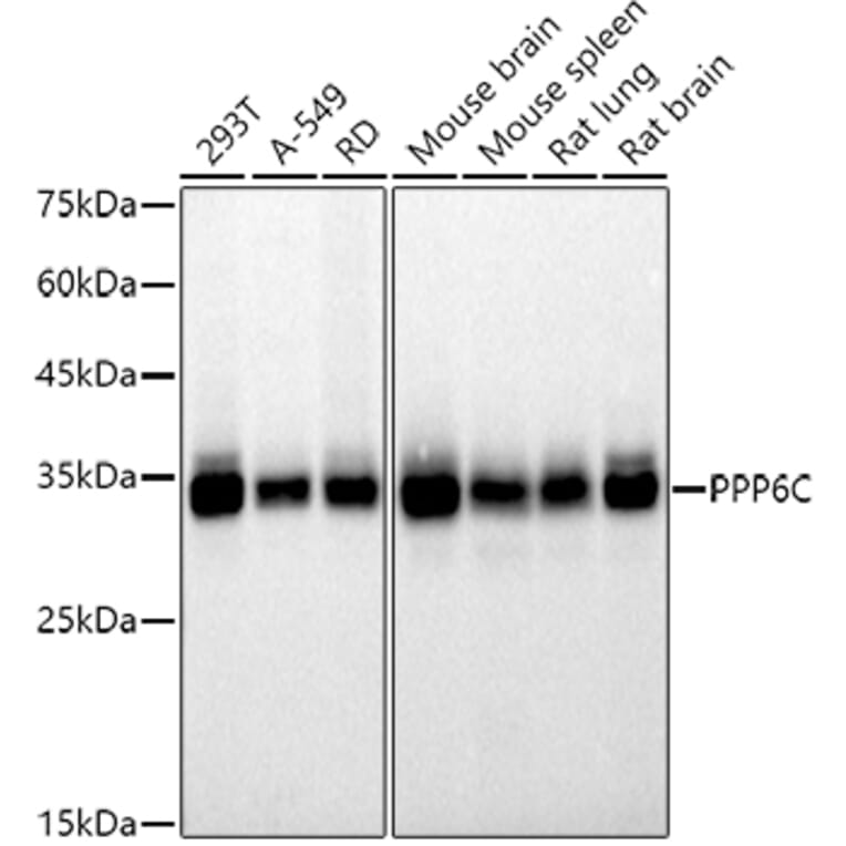 Western Blot - Anti-PPP6C/Ppv Antibody [ARC2709] (A305343) - Antibodies.com