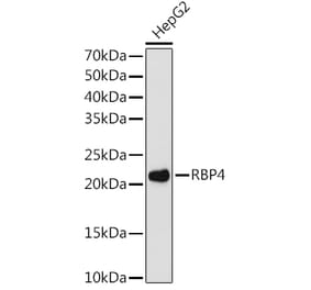 Western Blot - Anti-RBP4 Antibody [ARC1311] (A305344) - Antibodies.com