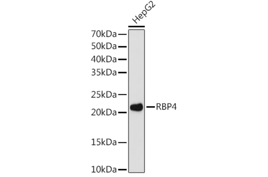 Western Blot - Anti-RBP4 Antibody [ARC1311] (A305344) - Antibodies.com