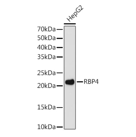 Western Blot - Anti-RBP4 Antibody [ARC1311] (A305344) - Antibodies.com