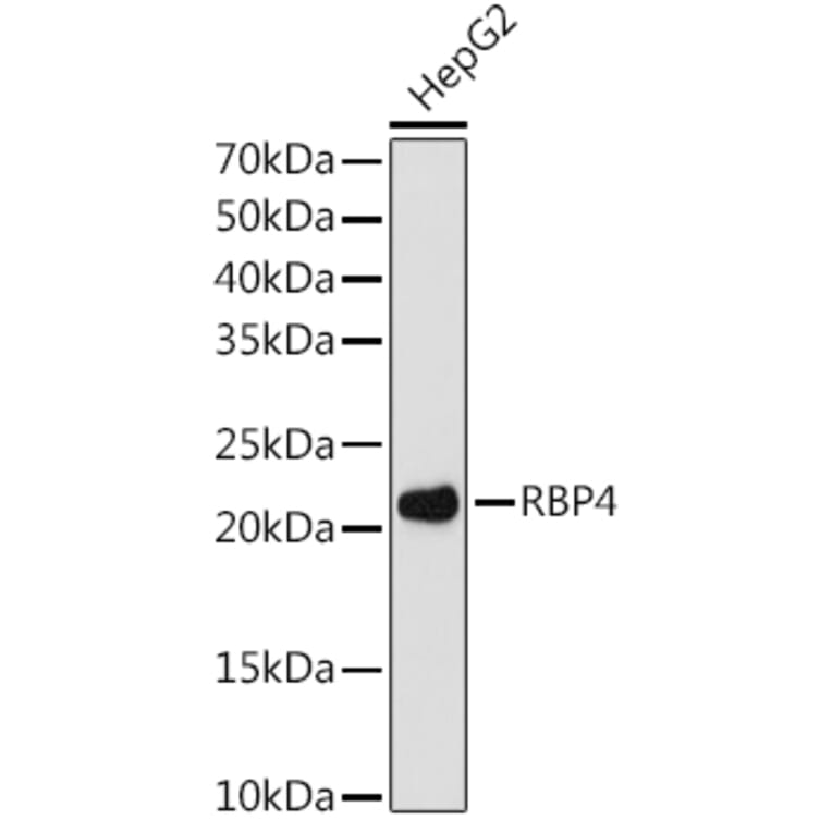 Western Blot - Anti-RBP4 Antibody [ARC1311] (A305344) - Antibodies.com