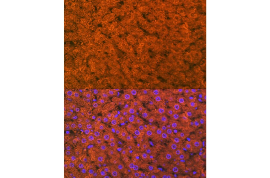 Immunofluorescence - Anti-RBP4 Antibody [ARC1311] (A305344) - Antibodies.com