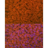 Immunofluorescence - Anti-RBP4 Antibody [ARC1311] (A305344) - Antibodies.com