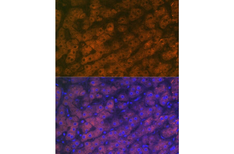 Immunofluorescence - Anti-RBP4 Antibody [ARC1311] (A305344) - Antibodies.com