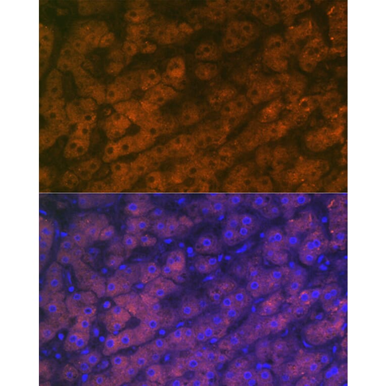 Immunofluorescence - Anti-RBP4 Antibody [ARC1311] (A305344) - Antibodies.com