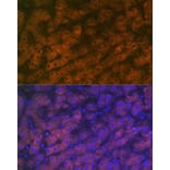 Immunofluorescence - Anti-RBP4 Antibody [ARC1311] (A305344) - Antibodies.com