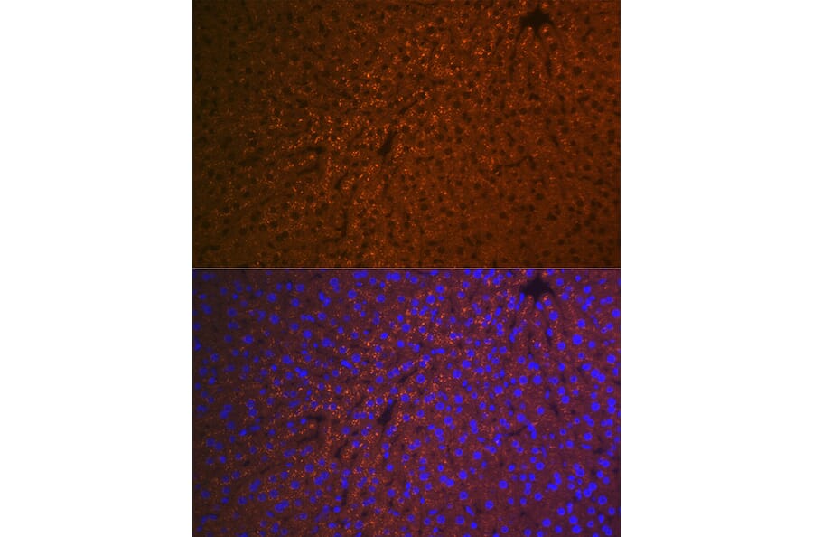 Immunofluorescence - Anti-RBP4 Antibody [ARC1311] (A305344) - Antibodies.com