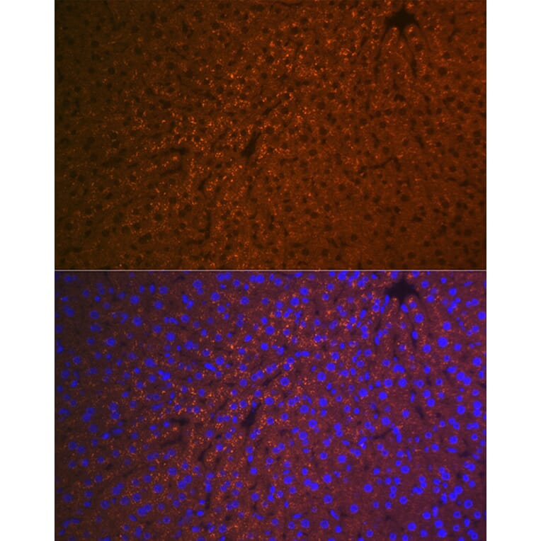 Immunofluorescence - Anti-RBP4 Antibody [ARC1311] (A305344) - Antibodies.com