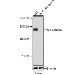 Western Blot - Anti-N Cadherin Antibody [ARC0371] (A305345) - Antibodies.com