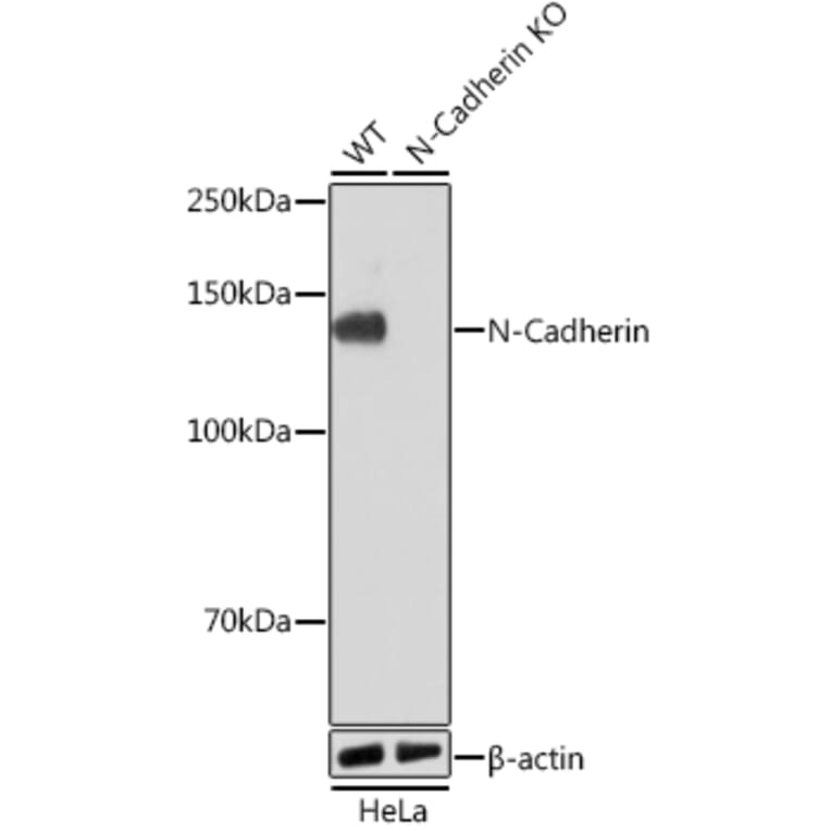 Western Blot - Anti-N Cadherin Antibody [ARC0371] (A305345) - Antibodies.com