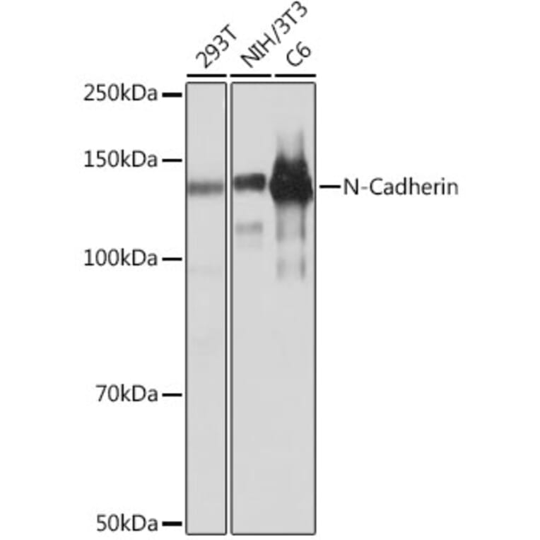 Western Blot - Anti-N Cadherin Antibody [ARC0371] (A305345) - Antibodies.com