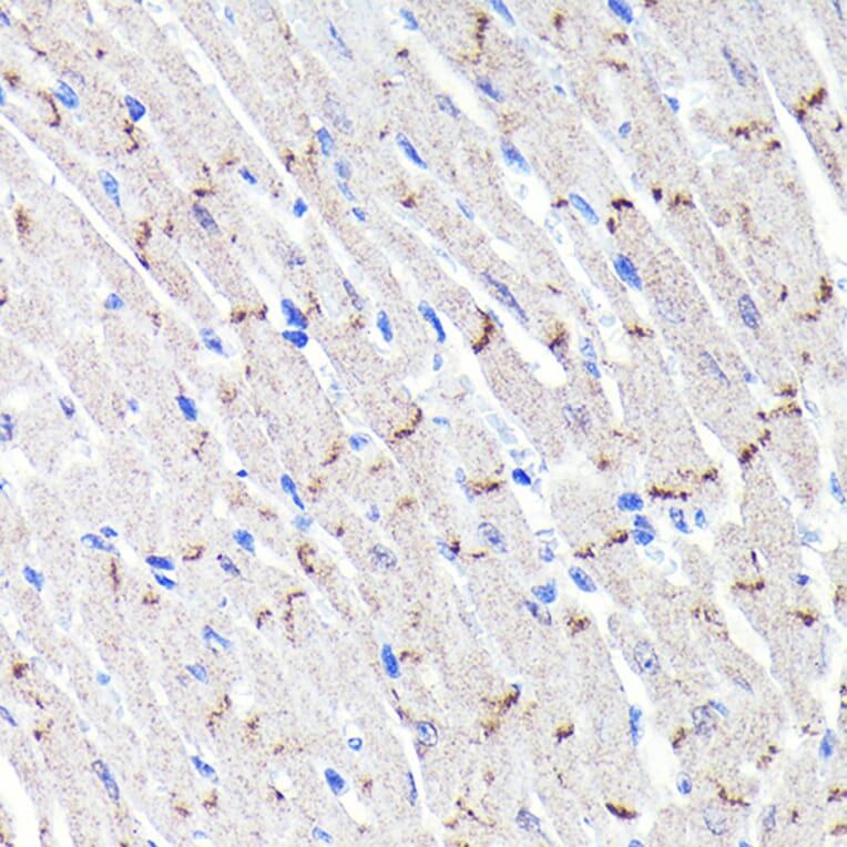 Immunohistochemistry - Anti-N Cadherin Antibody [ARC0371] (A305345) - Antibodies.com