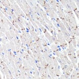 Immunohistochemistry - Anti-N Cadherin Antibody [ARC0371] (A305345) - Antibodies.com