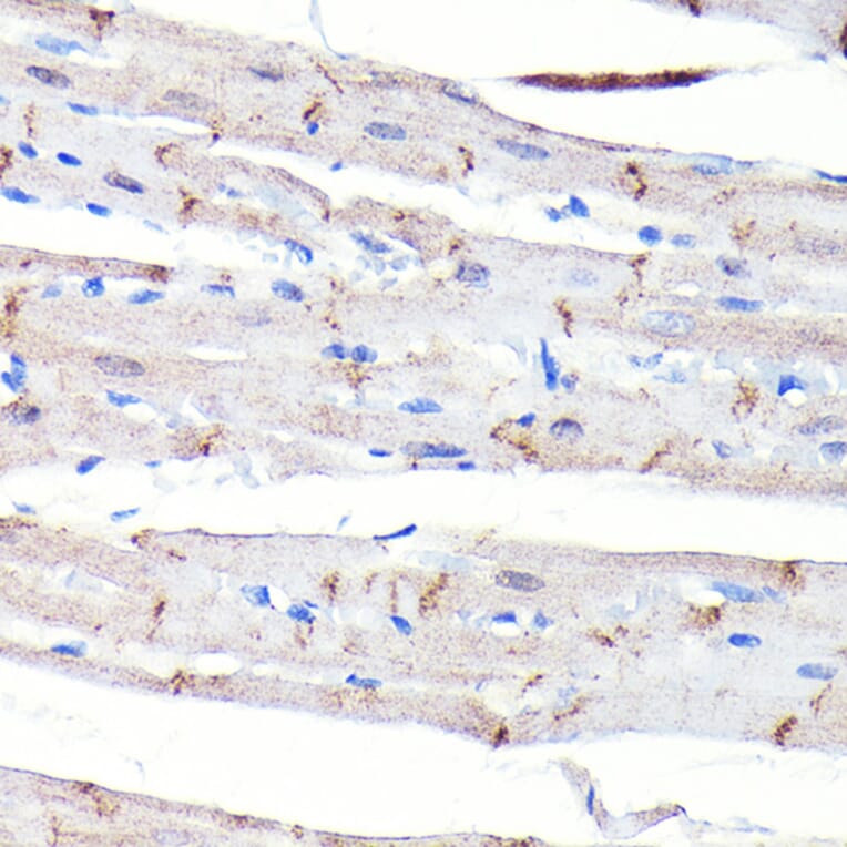 Immunohistochemistry - Anti-N Cadherin Antibody [ARC0371] (A305345) - Antibodies.com