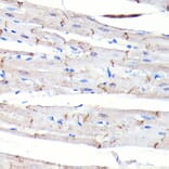Immunohistochemistry - Anti-N Cadherin Antibody [ARC0371] (A305345) - Antibodies.com