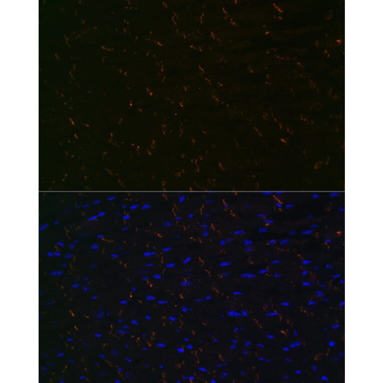 Immunofluorescence - Anti-N Cadherin Antibody [ARC0371] (A305345) - Antibodies.com