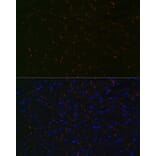 Immunofluorescence - Anti-N Cadherin Antibody [ARC0371] (A305345) - Antibodies.com