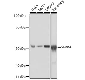 Western Blot - Anti-SFRP4 Antibody [ARC0923] (A305346) - Antibodies.com