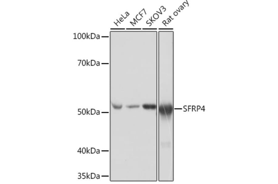 Western Blot - Anti-SFRP4 Antibody [ARC0923] (A305346) - Antibodies.com