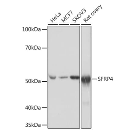Western Blot - Anti-SFRP4 Antibody [ARC0923] (A305346) - Antibodies.com